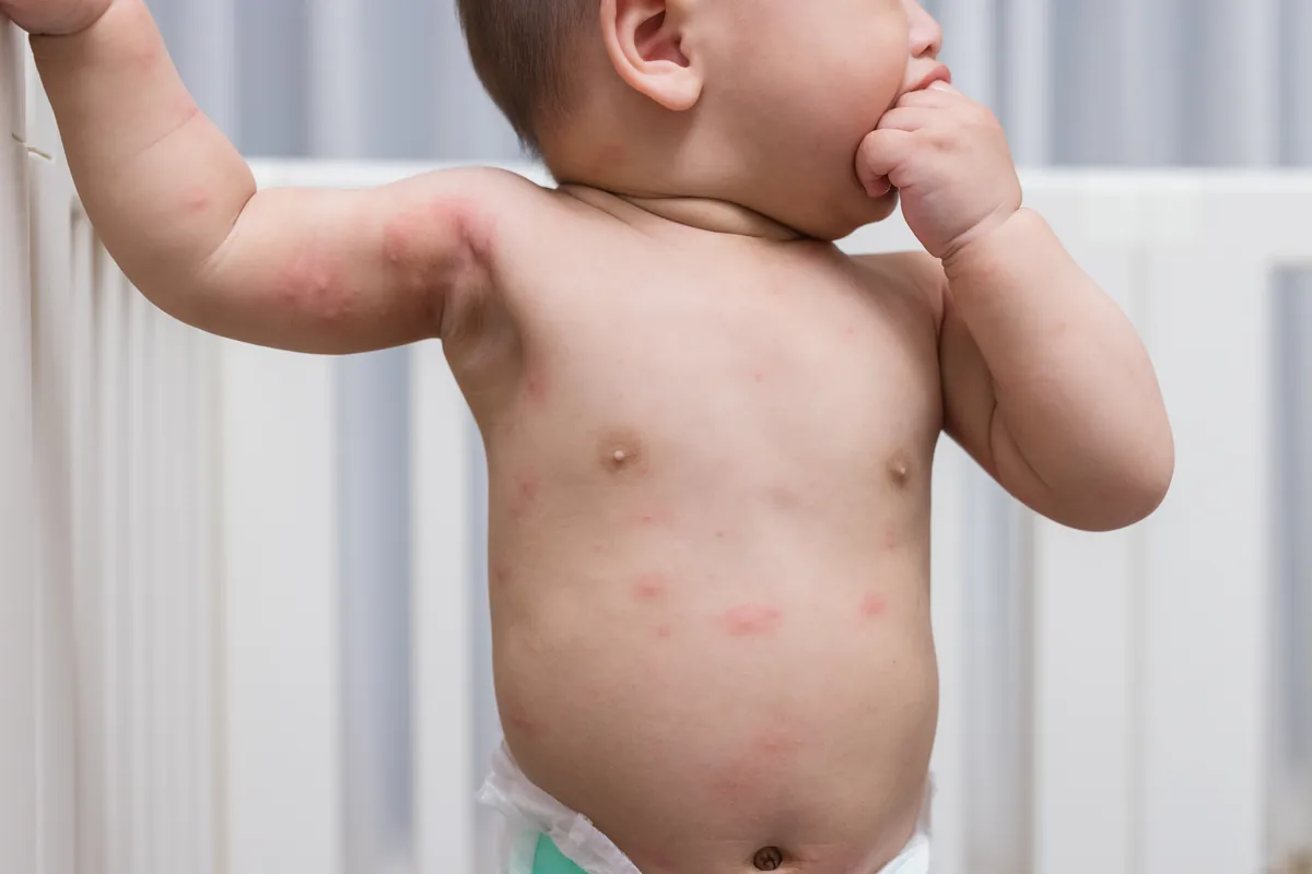 Will my baby have an allergic reaction?