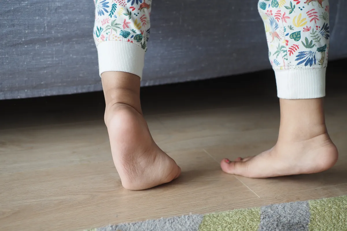 Todo lo que debes saber sobre el pie plano en niños