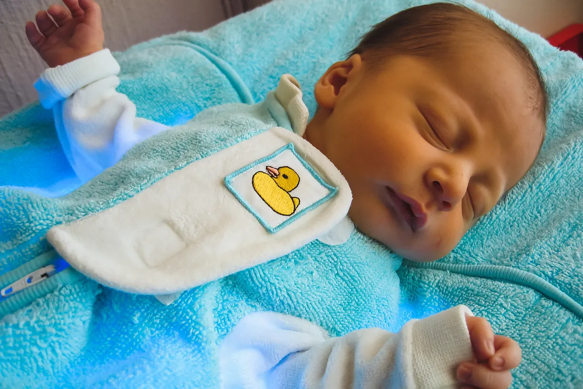What causes Jaundice in babies and What to do?