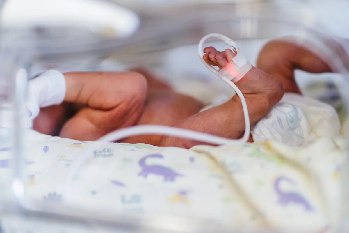 Bebés prematuros: ¿Qué cuidados necesitan?