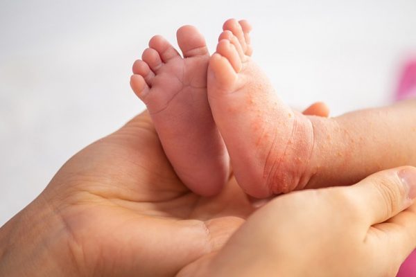 How can I keep myself and my baby safe from the Zika virus?