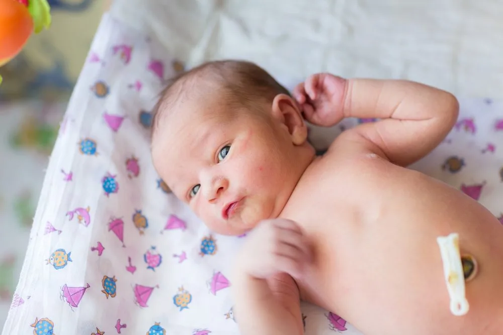 ¿Cómo cuidar el muñón de cordón umbilical?