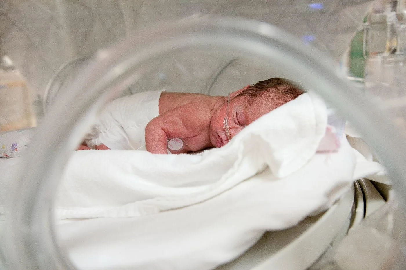 Parto prematuro: O que é, Sinais e Fatores de risco